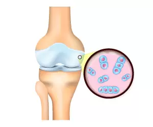 article-benefits-of-collagen-on-joint-01