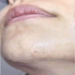 612501792_1300666492104012_6102914174869066224_n-300x300-1